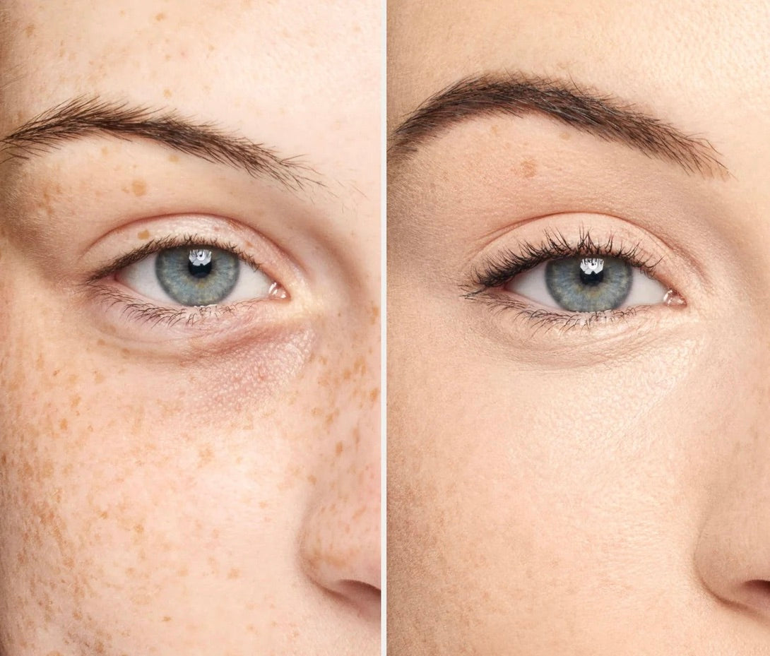 UNDER EYE ERASER
